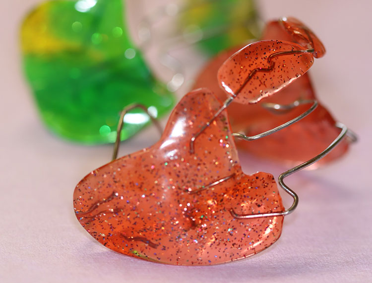 Lose Zahnspange im Detail