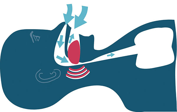 Grafik, die zeigt wie die Zunge nach hinten fällt und man dann schnarcht